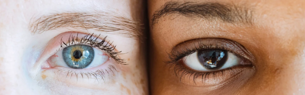 Augenlidstraffung-Oberlidstraffung-Lidkorrektur